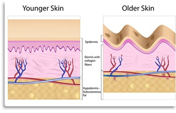 Skin Elasticity